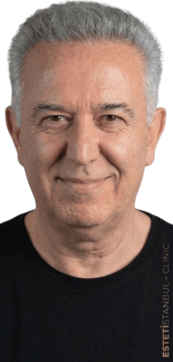 Luigi L. after